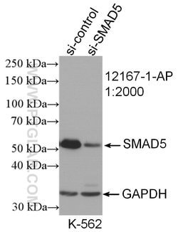 SMAD5 Rabbit anti-Human, Mouse, Rat, Polyclonal, Proteintech:Antibodies:Primary