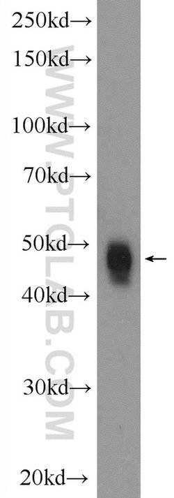 SMAD5 Rabbit anti-Human, Mouse, Rat, Polyclonal, Proteintech:Antibodies:Primary