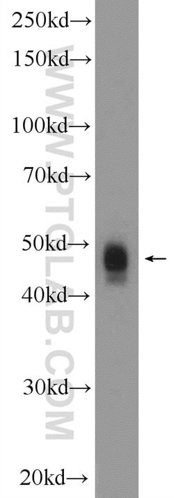 SMAD5 Rabbit anti-Human, Mouse, Rat, Polyclonal, Proteintech:Antibodies:Primary