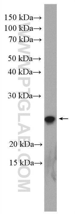 RPE Rabbit anti-Human, Mouse, Rat, Polyclonal, Proteintech:Antibodies:Primary