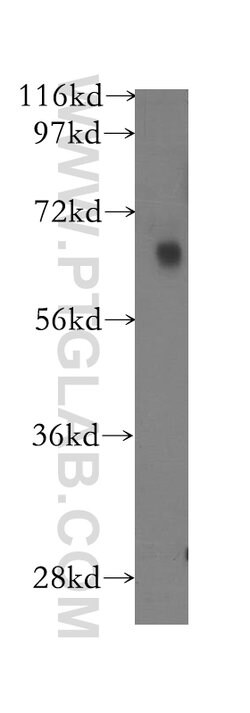 FKBP65 Rabbit anti-Human, Mouse, Rat, Polyclonal, Proteintech 150 &mu;L | Buy Online | Proteintech | Fisher Scientific