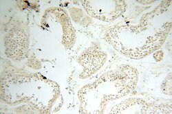 MT3 Rabbit anti-Human, Mouse, Rat, Polyclonal, Proteintech:Antibodies:Primary