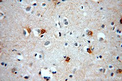 MT3 Rabbit anti-Human, Mouse, Rat, Polyclonal, Proteintech:Antibodies:Primary