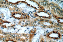 MT3 Rabbit anti-Human, Mouse, Rat, Polyclonal, Proteintech:Antibodies:Primary