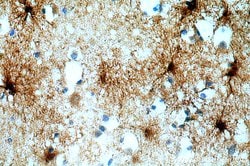 MT3 Rabbit anti-Human, Mouse, Rat, Polyclonal, Proteintech:Antibodies:Primary