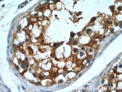 MT3 Rabbit anti-Human, Mouse, Rat, Polyclonal, Proteintech:Antibodies:Primary