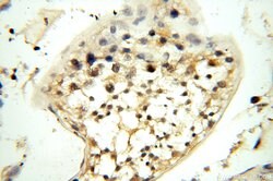 MT3 Rabbit anti-Human, Mouse, Rat, Polyclonal, Proteintech:Antibodies:Primary