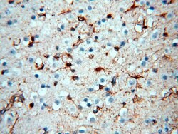 MT3 Rabbit anti-Human, Mouse, Rat, Polyclonal, Proteintech:Antibodies:Primary