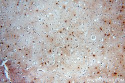 MT3 Rabbit anti-Human, Mouse, Rat, Polyclonal, Proteintech:Antibodies:Primary
