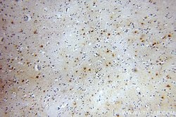 MT3 Rabbit anti-Human, Mouse, Rat, Polyclonal, Proteintech:Antibodies:Primary