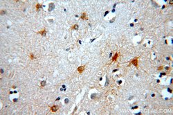 MT3 Rabbit anti-Human, Mouse, Rat, Polyclonal, Proteintech:Antibodies:Primary