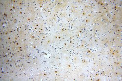 MT3 Rabbit anti-Human, Mouse, Rat, Polyclonal, Proteintech:Antibodies:Primary