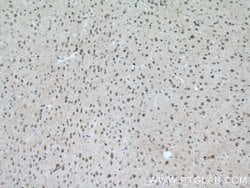 MT3 Rabbit anti-Human, Mouse, Rat, Polyclonal, Proteintech:Antibodies:Primary