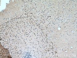 MT3 Rabbit anti-Human, Mouse, Rat, Polyclonal, Proteintech:Antibodies:Primary