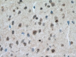 MT3 Rabbit anti-Human, Mouse, Rat, Polyclonal, Proteintech:Antibodies:Primary