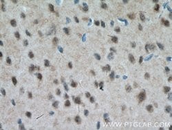 MT3 Rabbit anti-Human, Mouse, Rat, Polyclonal, Proteintech:Antibodies:Primary