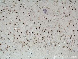 MED8 Rabbit anti-Human, Mouse, Polyclonal, Proteintech 150 &mu;L; Unconjugated:Antibodies,