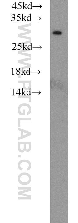 MED8 Rabbit anti-Human, Mouse, Polyclonal, Proteintech 150 &mu;L; Unconjugated:Antibodies,