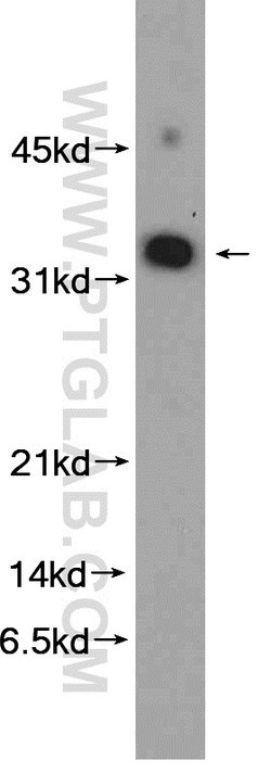 MED8 Rabbit anti-Human, Mouse, Polyclonal, Proteintech 150 &mu;L; Unconjugated:Antibodies,