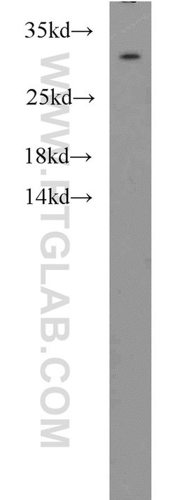 MED8 Rabbit anti-Human, Mouse, Polyclonal, Proteintech 150 &mu;L; Unconjugated:Antibodies,