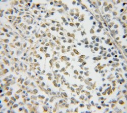 NXF2 Rabbit anti-Human, Mouse, Rat, Polyclonal, Proteintech 150 &mu;L;
