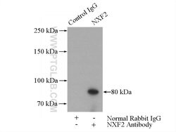 NXF2 Rabbit anti-Human, Mouse, Rat, Polyclonal, Proteintech 150 &mu;L;