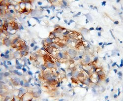 WWP2 Rabbit anti-Human, Mouse, Polyclonal, Proteintech