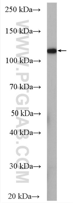 WWP2 Rabbit anti-Human, Mouse, Polyclonal, Proteintech:Anticorps:Anticorps
