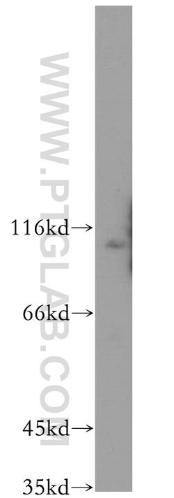 WWP2 Rabbit anti-Human, Mouse, Polyclonal, Proteintech:Anticorps:Anticorps