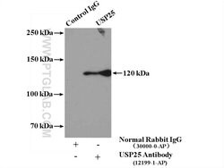 USP25 Rabbit anti-Human, Mouse, Rat, Polyclonal, Proteintech 150 &mu;L;