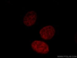 MATR3 Rabbit anti-Human, Mouse, Rat, Polyclonal, Proteintech:Antibodies:Primary