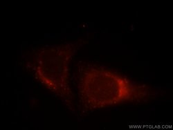 Syntaxin 8 Rabbit anti-Human, Mouse, Rat, Polyclonal, Proteintech:Antibodies:Primary