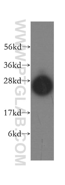 Syntaxin 8 Rabbit anti-Human, Mouse, Rat, Polyclonal, Proteintech:Antibodies:Primary