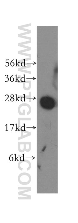 Syntaxin 8 Rabbit anti-Human, Mouse, Rat, Polyclonal, Proteintech:Antibodies:Primary
