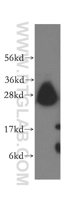 Syntaxin 8 Rabbit anti-Human, Mouse, Rat, Polyclonal, Proteintech:Antibodies:Primary