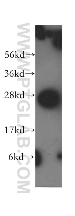 Syntaxin 8 Rabbit anti-Human, Mouse, Rat, Polyclonal, Proteintech:Antibodies:Primary