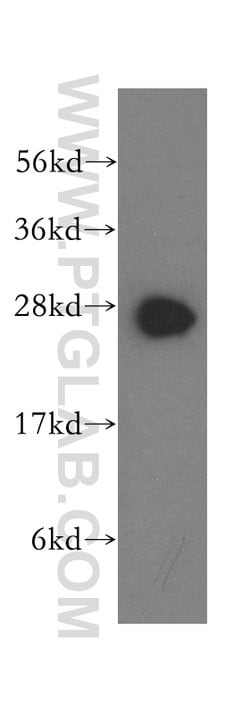 Syntaxin 8 Rabbit anti-Human, Mouse, Rat, Polyclonal, Proteintech:Antibodies:Primary
