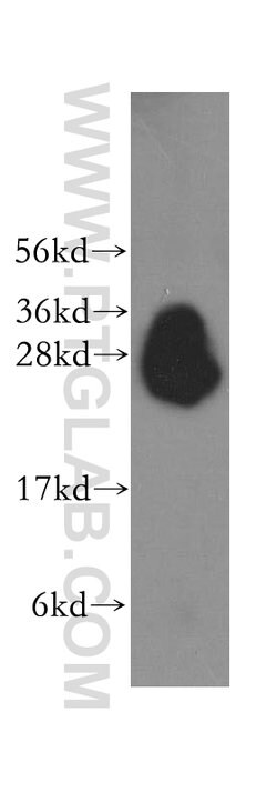 Syntaxin 8 Rabbit anti-Human, Mouse, Rat, Polyclonal, Proteintech:Antibodies:Primary