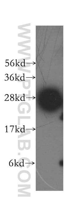 Syntaxin 8 Rabbit anti-Human, Mouse, Rat, Polyclonal, Proteintech:Antibodies:Primary