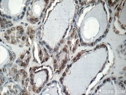 CREB1 Rabbit anti-Human, Mouse, Non-human primate, Rat, Polyclonal, Proteintech:Antibodies:Primary
