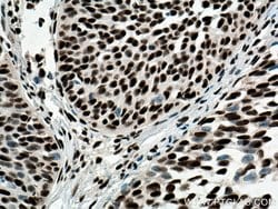 CREB1 Rabbit anti-Human, Mouse, Non-human primate, Rat, Polyclonal, Proteintech:Antibodies:Primary
