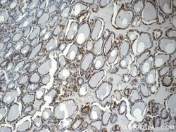 CREB1 Rabbit anti-Human, Mouse, Non-human primate, Rat, Polyclonal, Proteintech:Antibodies:Primary
