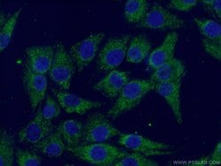 SSBP1 Rabbit anti-Human, Mouse, Rat, Polyclonal, Proteintech:Antibodies:Primary
