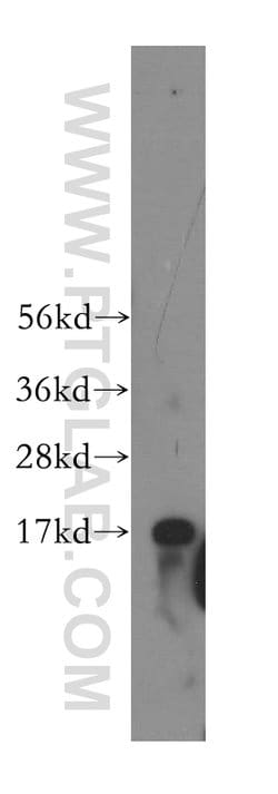 SSBP1 Rabbit anti-Human, Mouse, Rat, Polyclonal, Proteintech:Antibodies:Primary