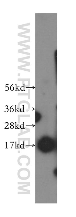 SSBP1 Rabbit anti-Human, Mouse, Rat, Polyclonal, Proteintech:Antibodies:Primary