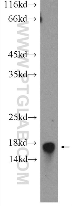 SSBP1 Rabbit anti-Human, Mouse, Rat, Polyclonal, Proteintech:Antibodies:Primary