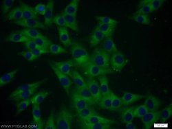Cathepsin B Rabbit anti-Human, Mouse, Polyclonal, Proteintech:Antibodies:Primary