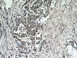 Cathepsin B Rabbit anti-Human, Mouse, Polyclonal, Proteintech:Antibodies:Primary