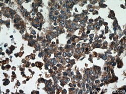 Cathepsin B Rabbit anti-Human, Mouse, Polyclonal, Proteintech:Antibodies:Primary