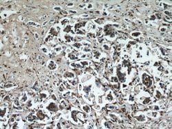 Cathepsin B Rabbit anti-Human, Mouse, Polyclonal, Proteintech:Antibodies:Primary